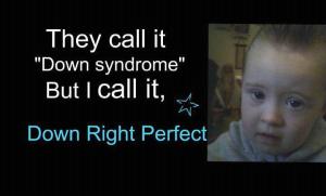 they call in down syndrome but