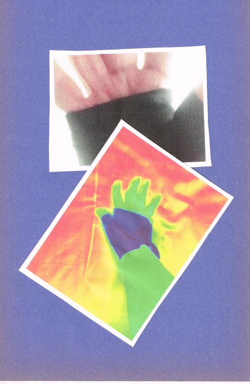 hand brace09212015_0000